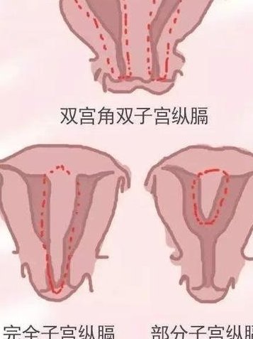 西安市儿童医院可以试管吗？